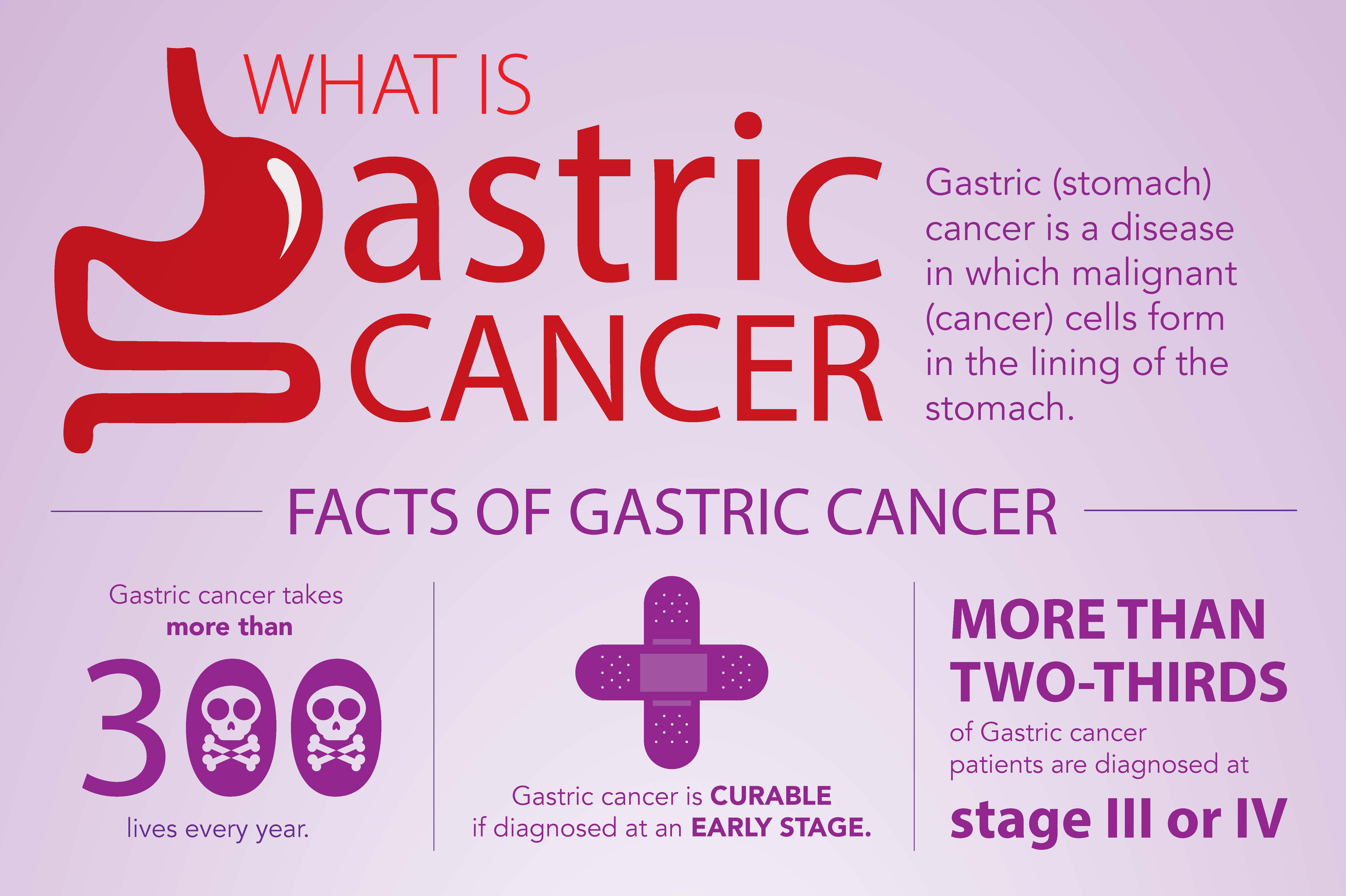 what is gastric cancer cancer colon recidive ganglion